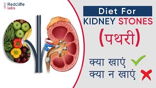 ✅ Diet for Kidney stones in Hindi  किडनी स्टोन में भूल से भी नहीं खाएं ये चीजें  Kidney Stone Diet [upl. by Eiddal]