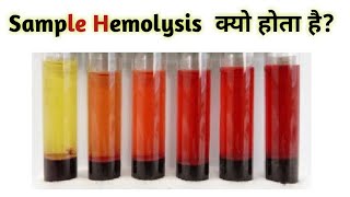 What is hemolysis  cause of hemolysis [upl. by Bitthia]