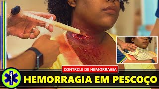 Controle de Hemorragias em Pescoço [upl. by Garreth]