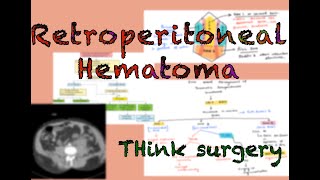 Retroperitoneum  radiological anatomy [upl. by Nalyad]