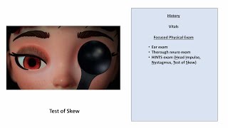 Hyperventilation Test Vestibular Examination [upl. by Aljan]