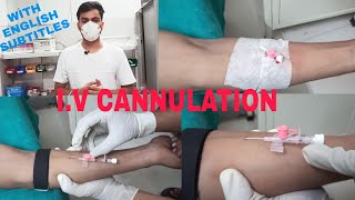 Intravenous Cannulation Technique  Iv Cannulation Procedure [upl. by Wait]