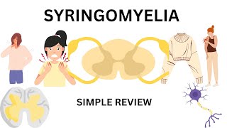 syringomyelia  featurescauses and treatment [upl. by Ebeneser]