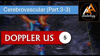 5  Cerebrovascular System Part 33 [upl. by Ro]