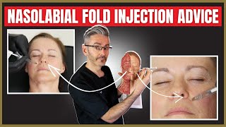 Nasolabial fold injection advice  Botox vs Filler [upl. by Notgnirra394]