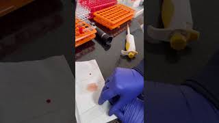 Confira com é feito o esfregaço sanguíneo no laboratório clínico veterinário [upl. by Inanaup191]