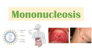 Irritable Bowel Syndrome IBS Causes Symptoms Bristol Stool Chart Types and Treatment [upl. by Ytram]