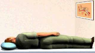 Log Roll Treatment for BPPV [upl. by Nosreffej937]