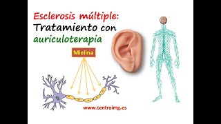 83 El tratamiento de la ESCLEROSIS MÚLTIPLE con AURICULOTERAPIA Curso auriculoterapia Centro IMG [upl. by Eiddam]