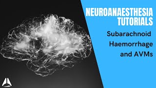 Neuroanaesthesia tute part 1 Subarachnoid haemorrhage and AVM [upl. by Anilos304]