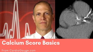 Calcium Score Basics What the Calcium Score is and how you can use it to understand your risks [upl. by Bearnard825]