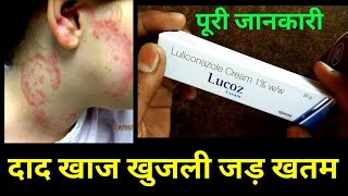 Lucoz cream Uses in hindi  Luliconazole Cream Uses in hindi [upl. by Benedikta553]