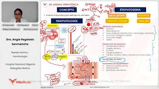 ANEMIA FERROPÉNICA  HEMATOLOGÍA  VILLAMEDIC [upl. by Eolc616]