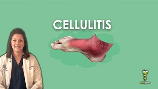 Cellulitis [upl. by Hefter]