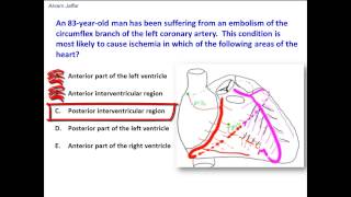 Left Circumflex Coronary Artery Anatomy on CTA [upl. by Bendicty]