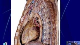 ANATOMIA MEDIASTINO PLEURA [upl. by Oyek]