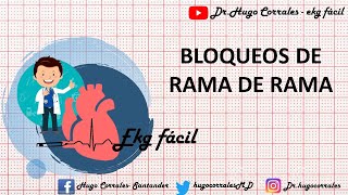 BLOQUEOS DE RAMA EN EL EKG ECG derecha e izquierda [upl. by Latton135]