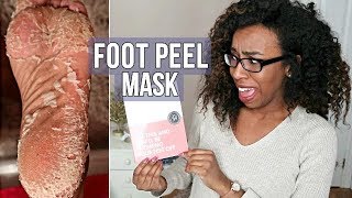 Foot Peel Mask CRAZY RESULTS [upl. by Monahan824]