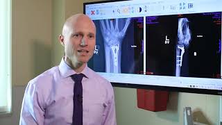 Broken Wrists Fracture Types Treatment Options amp Recovery  Dr Froelich [upl. by Sunderland404]