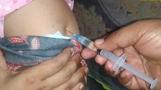 IM Intramuscular Arm injection PushPheniramine Meleate Avil 24 Ep 121 Anik Health Tips [upl. by Chandal754]