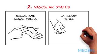 Hand andor Wrist Injuries How to easily test nerve function [upl. by Cheryl529]