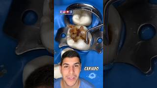 Você já teve dor de dente dentes curiosidades dentista dentesbrancos dicas dentadura [upl. by Ayahs28]