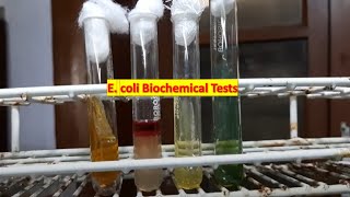 E coli Biochemical tests Demonstration [upl. by Ajak]