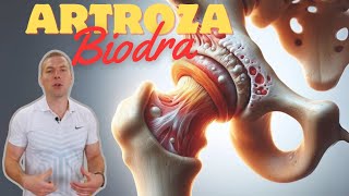 pokonaj swoje ZWYRODNIENIA BIODRA  trzask w biodrze endoproteza [upl. by Ajak]