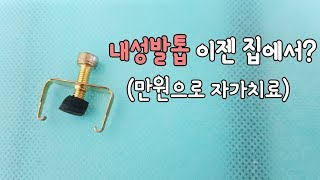 내성발톱 자가치료 내성발톱 교정기 내성발톱 집에서 내성발톱 교정 [upl. by Halimak447]