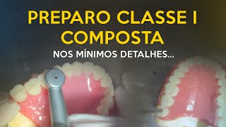 Preparo Classe I composta nos mínimos detalhes  DENTÍSTICA [upl. by Atoiganap147]