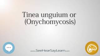 Tinea unguium or Onychomycosis 🔊 [upl. by Lamberto]