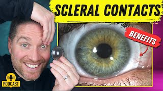 The Amazing Benefits Of Scleral Contact Lenses [upl. by Etnor]