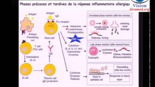 Asthme Immunopathologie Physiopathologie de lasthme allergique actualité explication [upl. by Sine654]