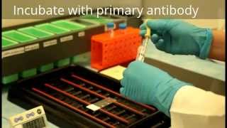 Immunohistochemistry  Procedure [upl. by Trilbi]