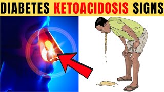 8 Fatal Diabetic Ketoacidosis Symptoms Most Diabetics Ignore [upl. by Anselme]