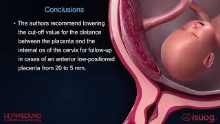 New UOG video abstract on placenta previa and low‐lying placenta second trimester ultrasound [upl. by Doowyah]