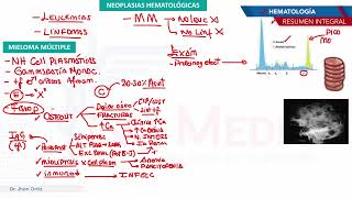 Hematología  Neoplasias mieloma multiple [upl. by Peursem]