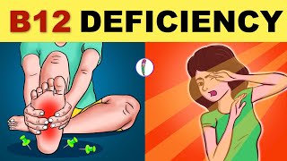 Vitamin B12 Deficiency Symptoms  B12 Deficiency  Vitamin B12  All You Need to Know [upl. by Iidnarb92]