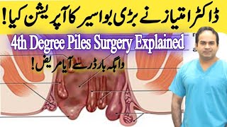 Operation of 4th Degree Piles  Haemorrhoidectomy of very big Piles  Surgeon Dr Imtiaz Hussain [upl. by Anoi912]