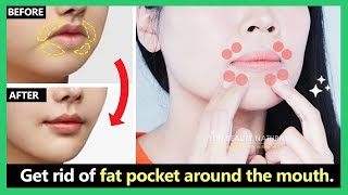 4 mins for Beautiful lips Get rid of perioral mound fat pocket around the mouth [upl. by Charleton]