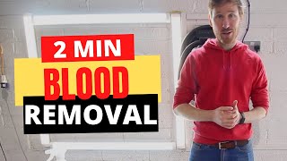 How To Clean Blood Stains With Hydrogen Peroxide [upl. by Aviv]