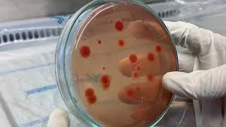Différence entre les salmonelles et les sighella sur la gelose SS et autres bactéries type Ecoli [upl. by Esaertal153]