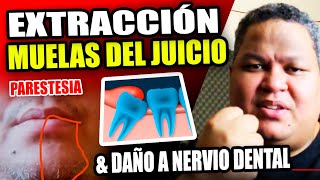 Extracción Muelas del Juicio Daño en Nervio Dental [upl. by Errick]