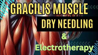 Dry Needling Therapy for Gracilis Muscle  Effective Treatment for Pain Relief amp Muscle Recovery [upl. by Levey]