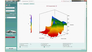 Wideband Tympanometry WBT Theory and Benefits [upl. by Tien]