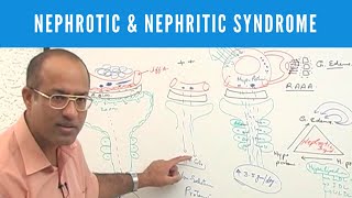 Nephrotic and Nephritic Syndrome  Causes Symptoms amp Treatment🩺 [upl. by Yardna]