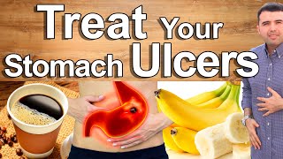 Do This And Cure Your Stomach Pain Gastritis and Ulcers  Best Natural Treatment of Stomach Pain [upl. by Hartzel947]