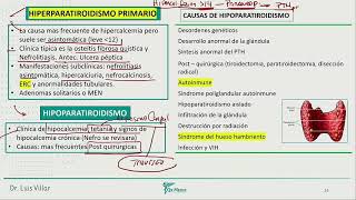 Endocrinología  Hipertiroidismo primario [upl. by Rese649]