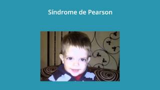 sindrome de Pearson [upl. by Ambur]