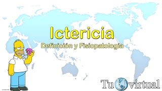 Ictericia fisiopatología y metabolismo de la bilirrubina con imágenes clínicas [upl. by Llywellyn]